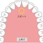 正しい舌の位置