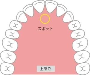 正しい舌の位置